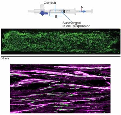 Optimal Technique for Introducing Schwann Cells Into Peripheral Nerve Repair Sites